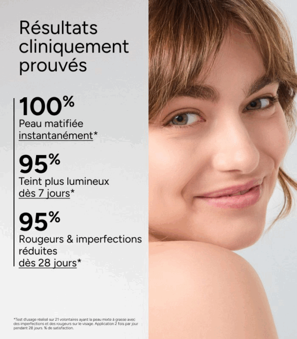 ACM Azéane Creme Acide Azelaique 15% 30 ml – Image 3