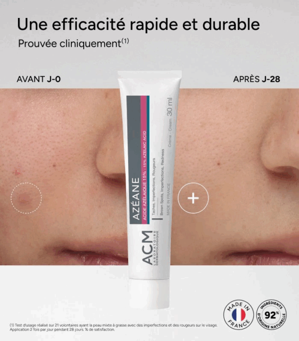 ACM Azéane Creme Acide Azelaique 15% 30 ml – Image 2